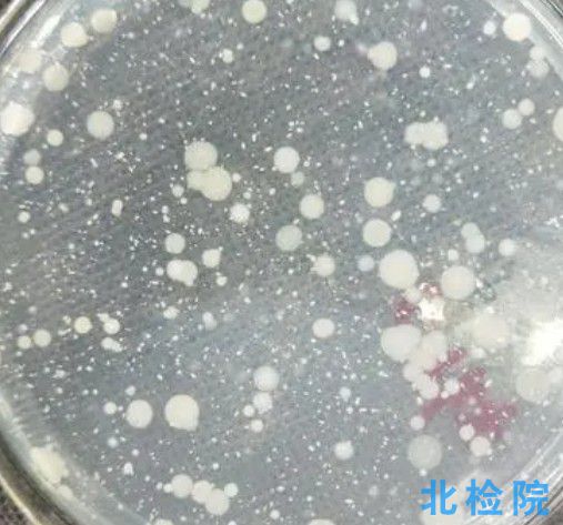 菌落總數(shù)檢測